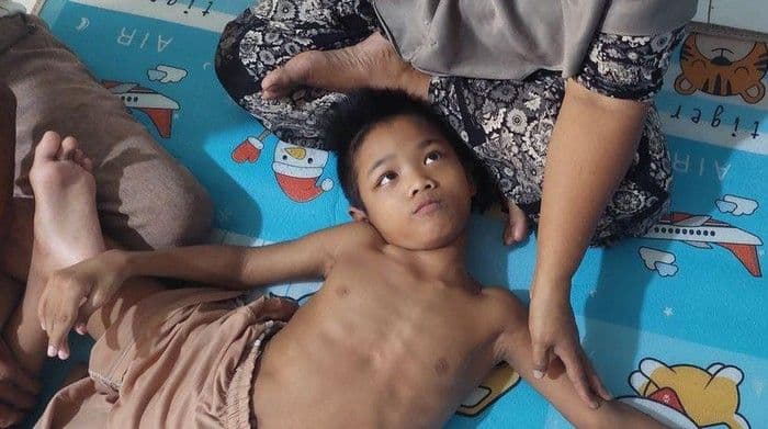 Anak dengan Cerebral Palsy Ditelantarkan Ibu, Terpaksa Ditinggal dalam Keadaan Memprihatinkan